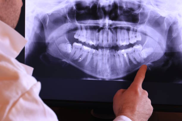Professional Emergency Dental Service in SC