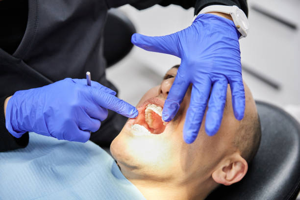 Best Emergency Root Canal Therapy in Sangaree, SC