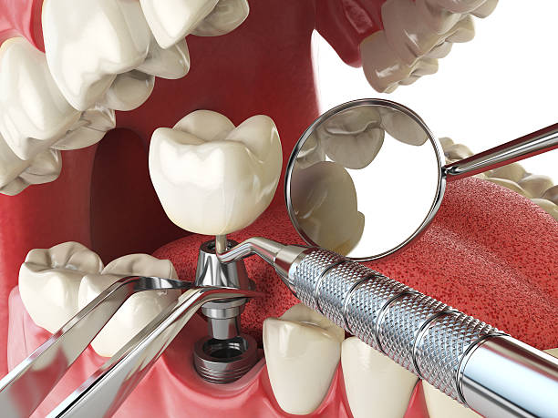 Best Emergency Denture Repair in Sangaree, SC